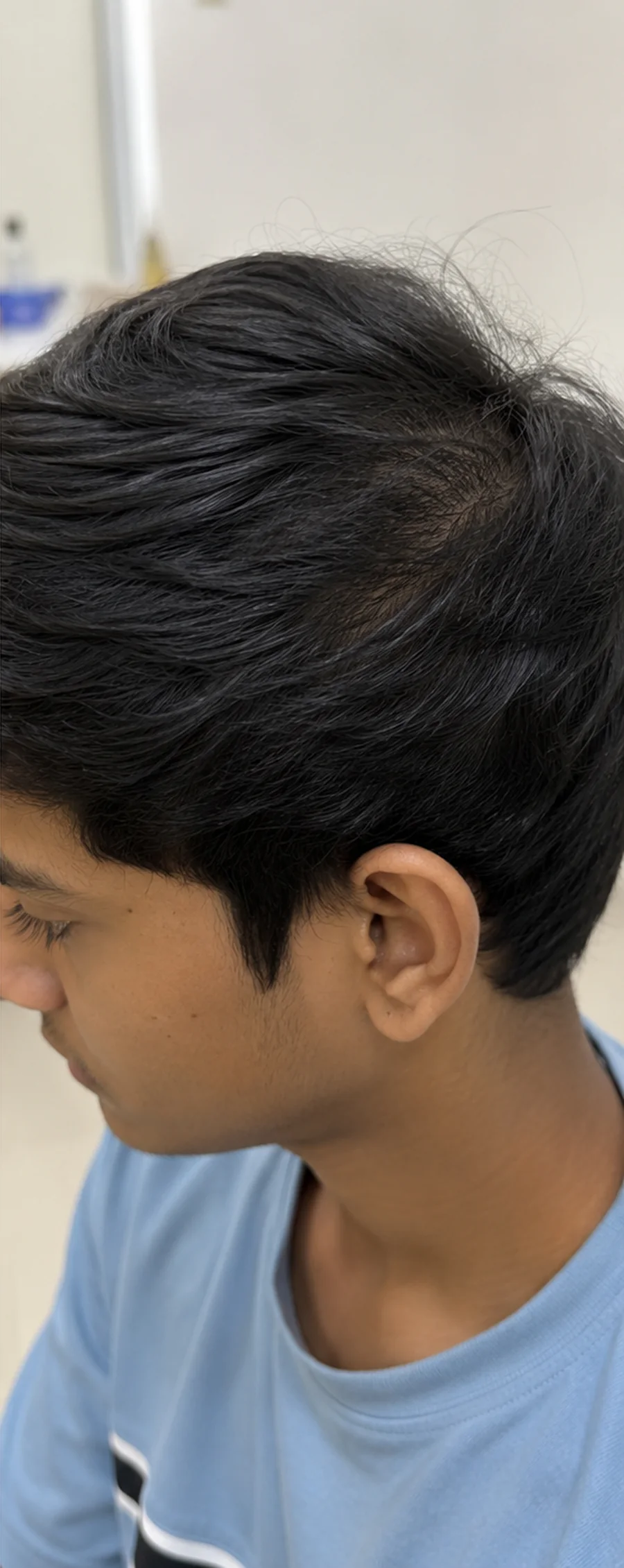 Patchy Hair Loss after treatment