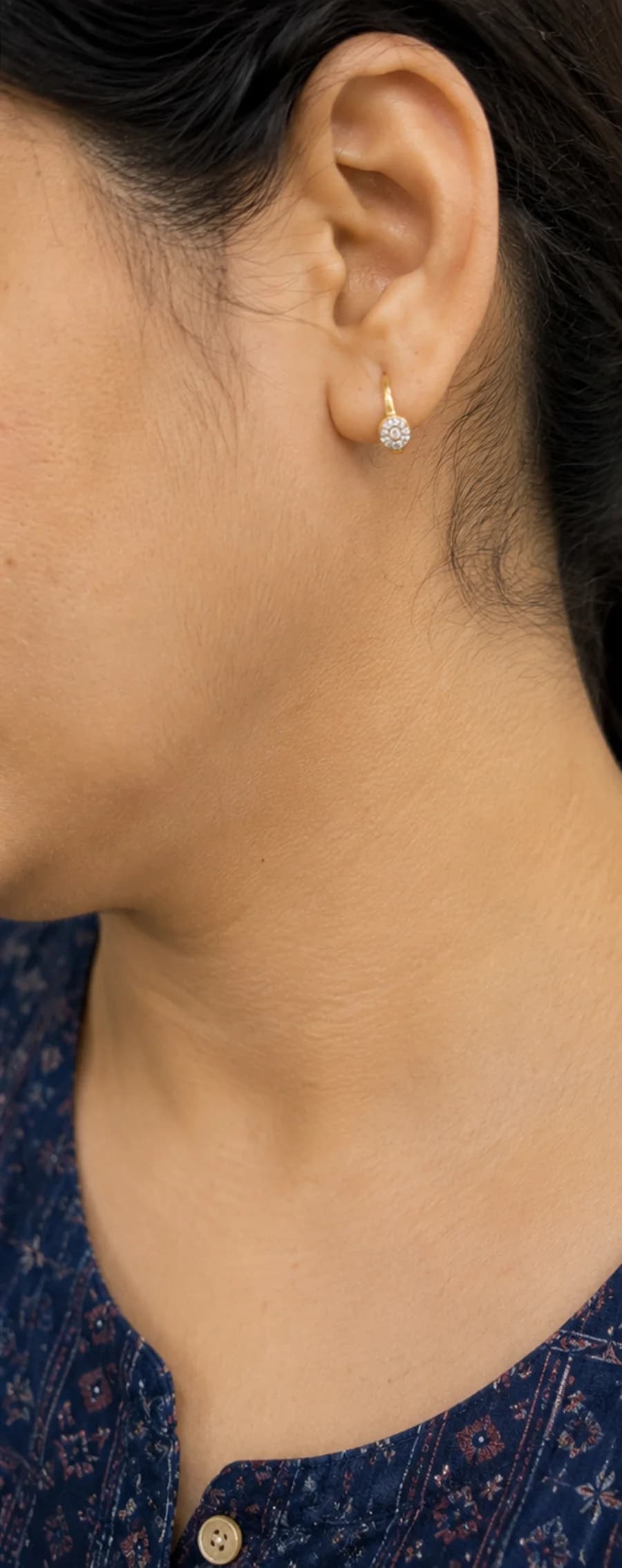 Warts & Skin Tags after treatment